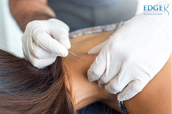 Physical Therapy Dry Needling in Singapore