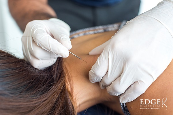 Recovering From Injuries Faster With Dry Needling